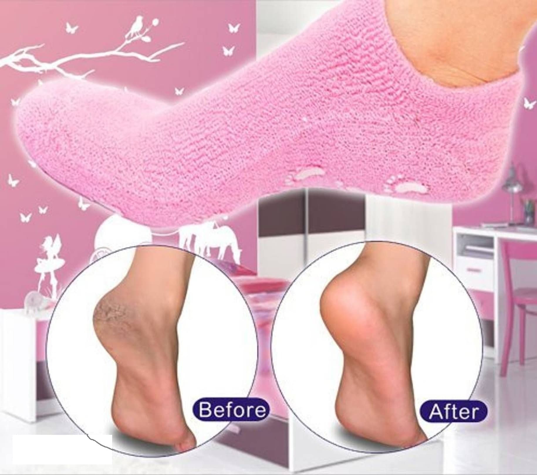 Premium SPA Gel Heel Socks | Colorful Moisturizing Heel Crack Protectors | 1 Pair Healthy Gel Foot Care | Random Color